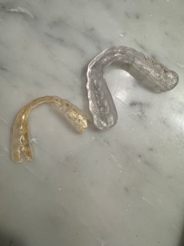 Yellowed old retainer next to a clear one - customer photo from Priya N.